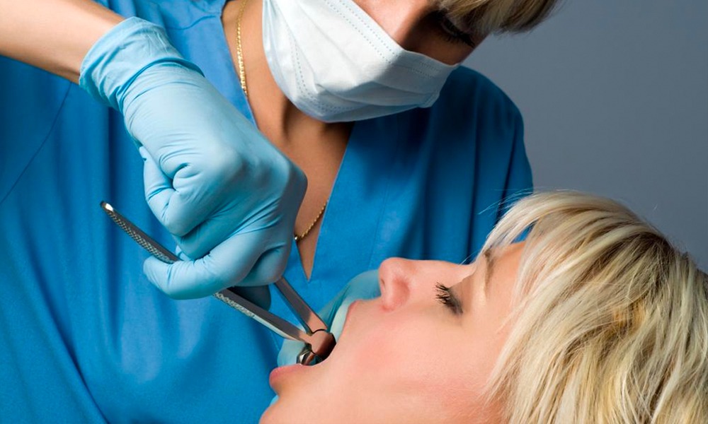 Extraccion segura y confiable por un equipo de dentistas altamente profesionales.