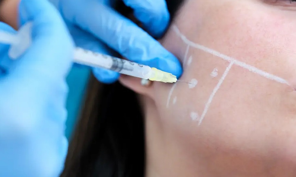 Ofrecemos tratamiento de botox para el bruxismo.