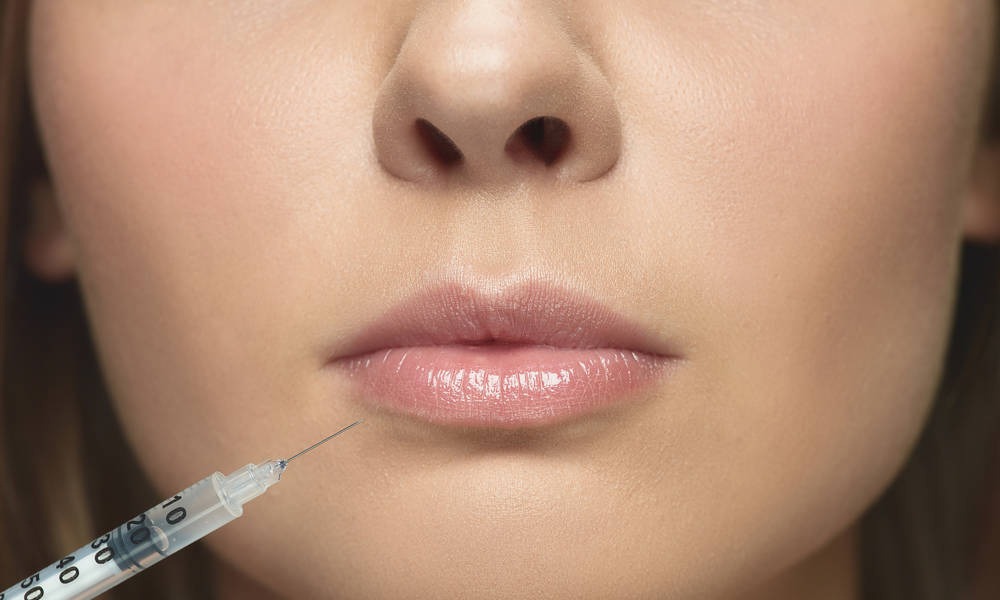 Tambien tenemos servicio de aumento de labios seguro y accesible.