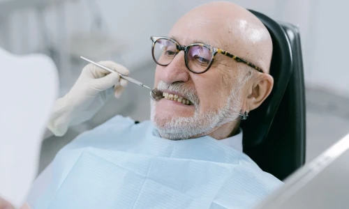 A qué edad empiezan a caerse los dientes en la vejez