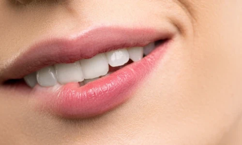 ¿Qué enchueca los dientes?