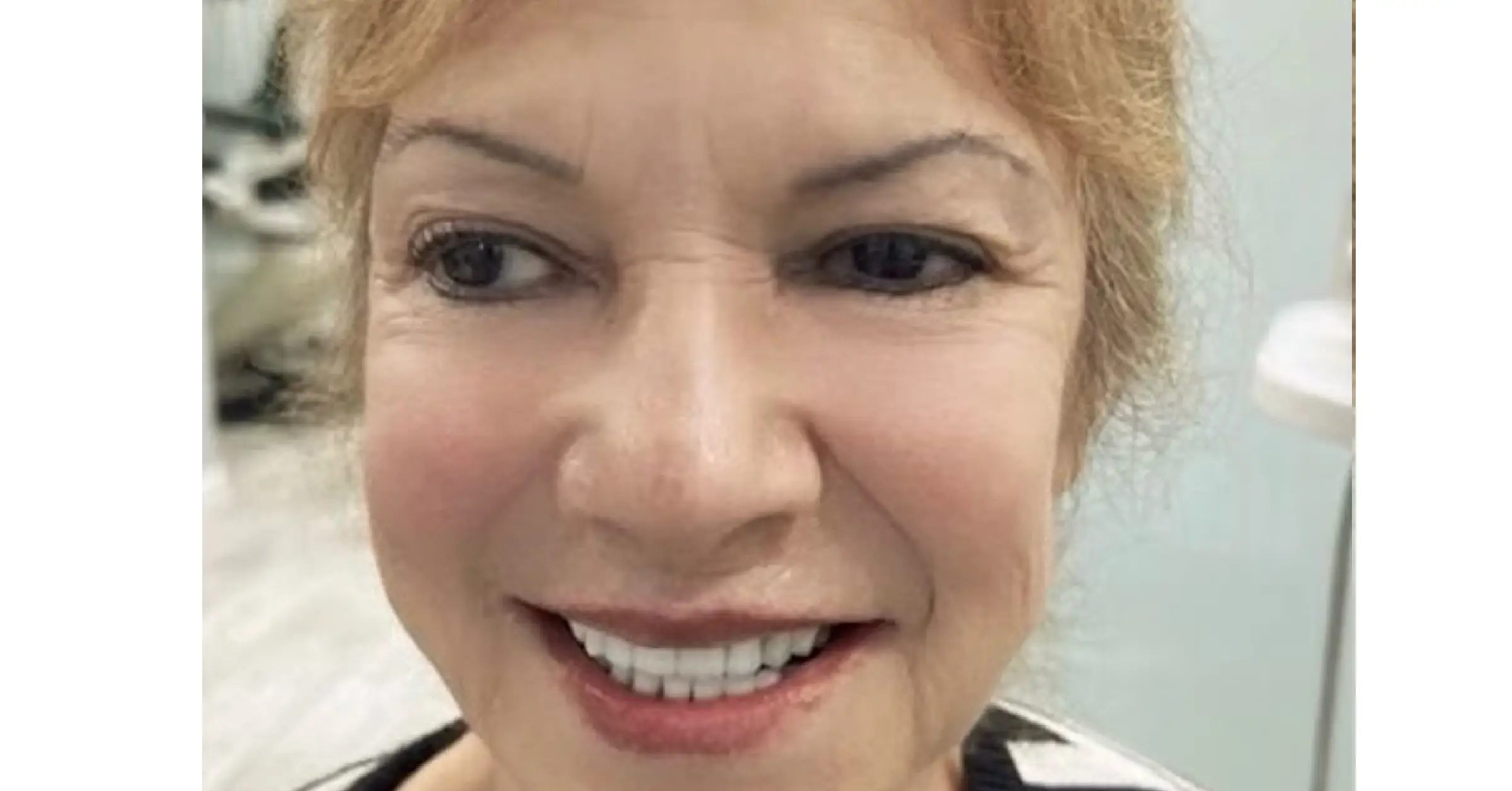 Ortodoncia para adultos: ¿es demasiado tarde para alinear su sonrisa?