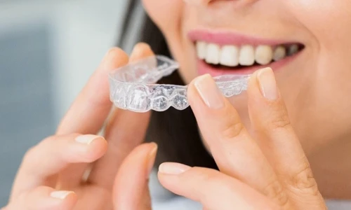 Ventajas de Invisalign