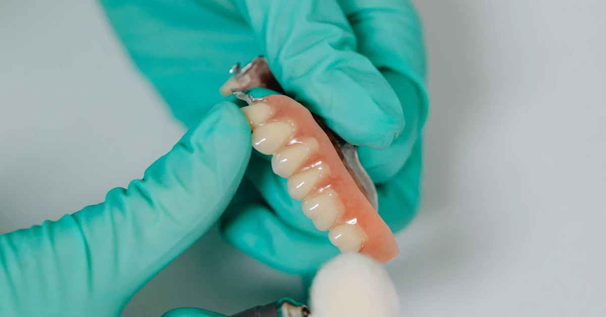¿Qué es una dentadura parcial?