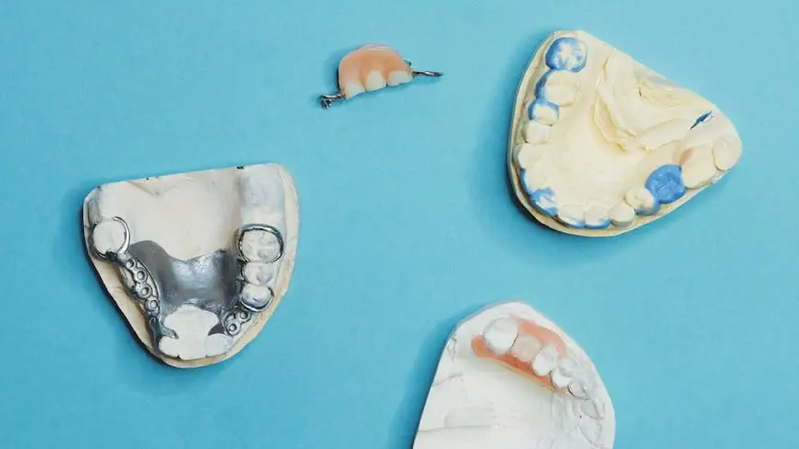 Función de los puentes dentales