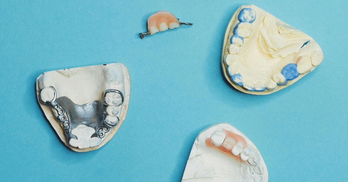 The Function of Dental Bridges