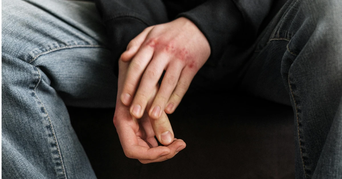 ¿Qué hacer después de un accidente de trabajo?