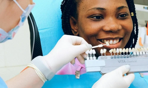 What Are Dental Veneers?