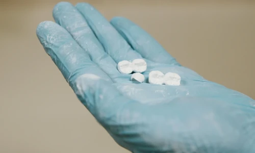 How Long Does a Dental Implant Last?