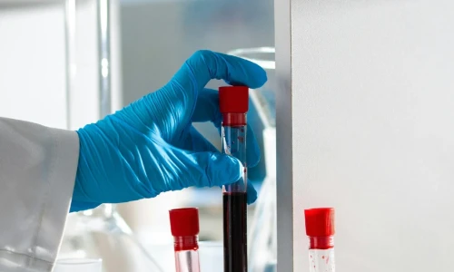 Do Immigration Medical Laboratories Need to Be Approved by USCIS?
