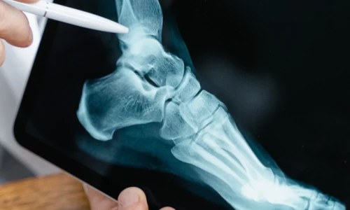 ¿Qué es la traumatología?