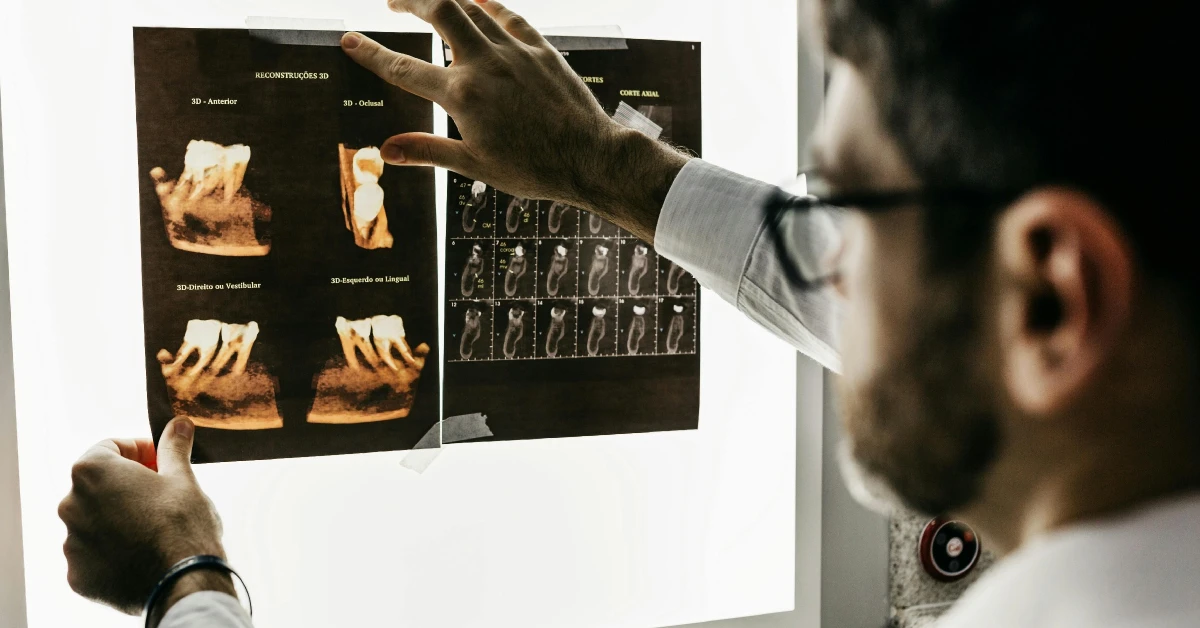 What Is a CT Scan in Odontology?
