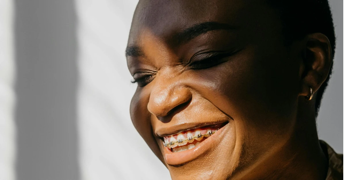 Can I Use Braces as an Adult?