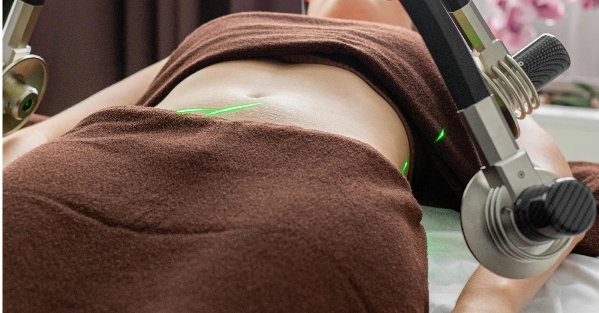 Partes del cuerpo donde puede hacerse una liposucción