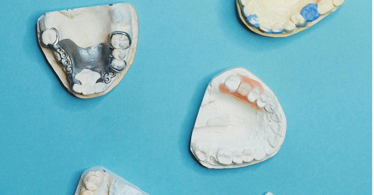 ¿Qué son los puentes dentales y cuándo se recomiendan?