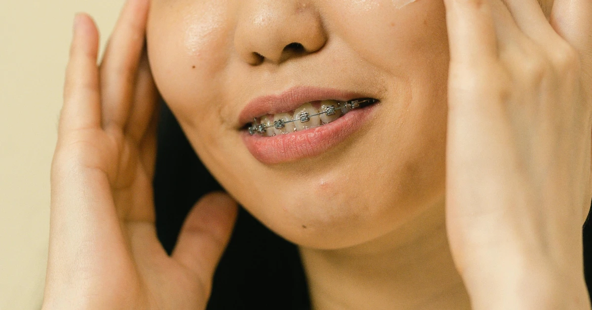 ¿Puedo usar brackets como adulto?