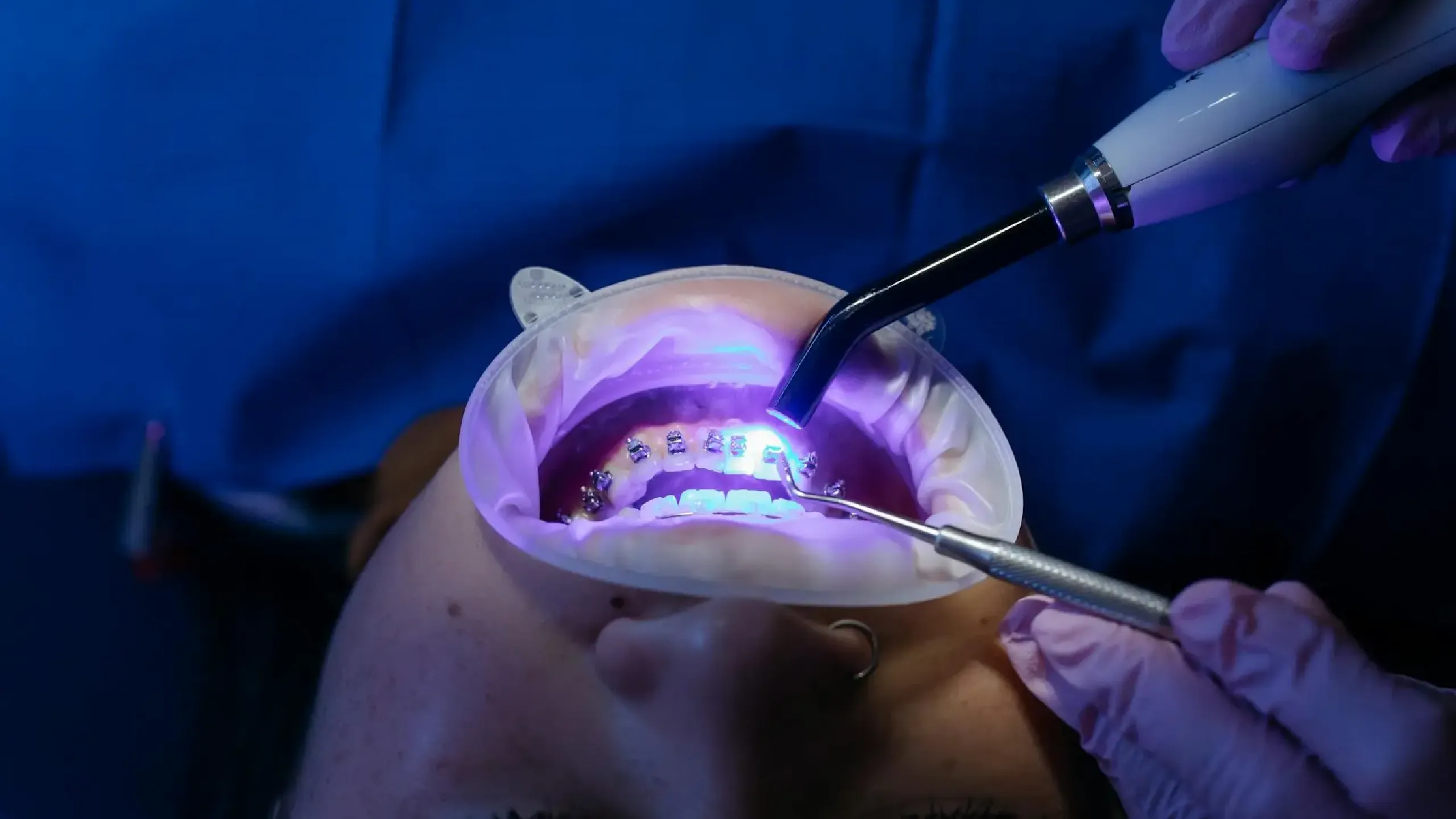 Servicios de ortodoncia: todo lo que necesita saber