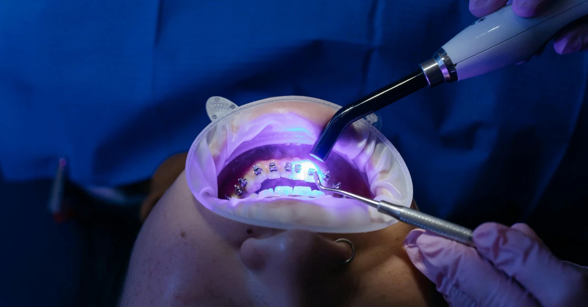 Orthodontic Services: Everything You Need to Know