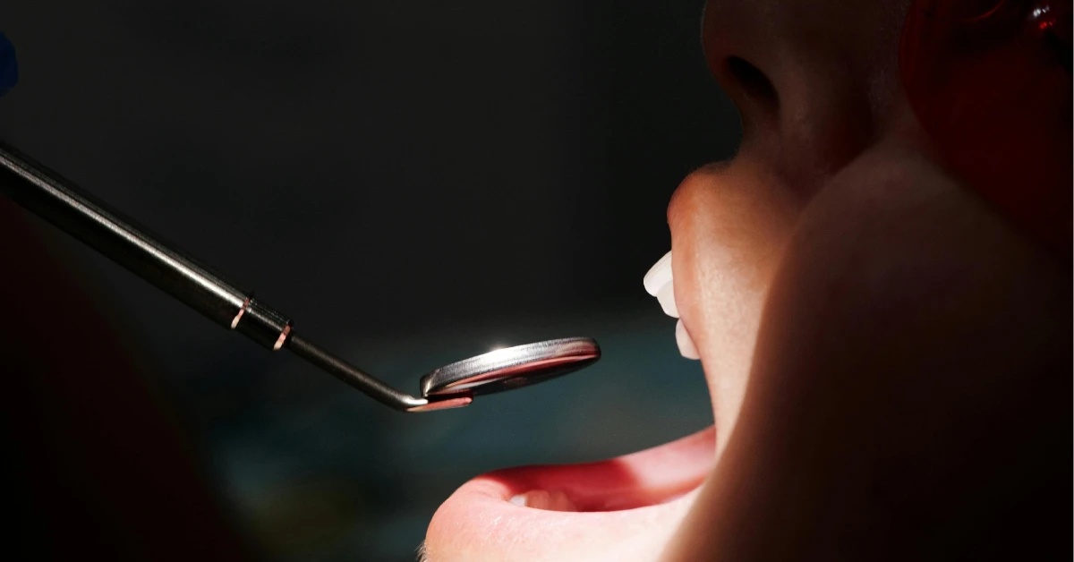 Understanding Gum Disease