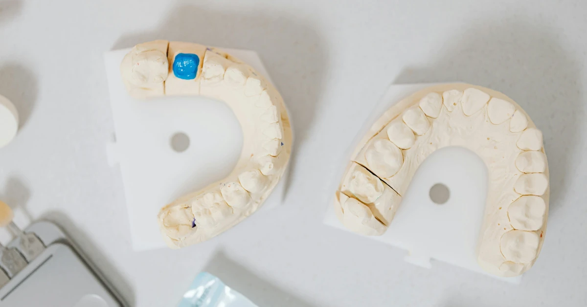 Implants vs. Dental Bridges: Which Is the Right Choice for You?