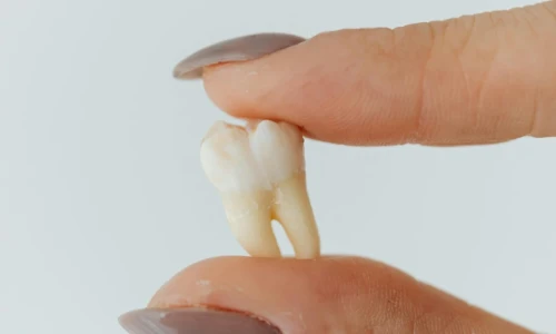 When Does a Child Need a Tooth Extraction?