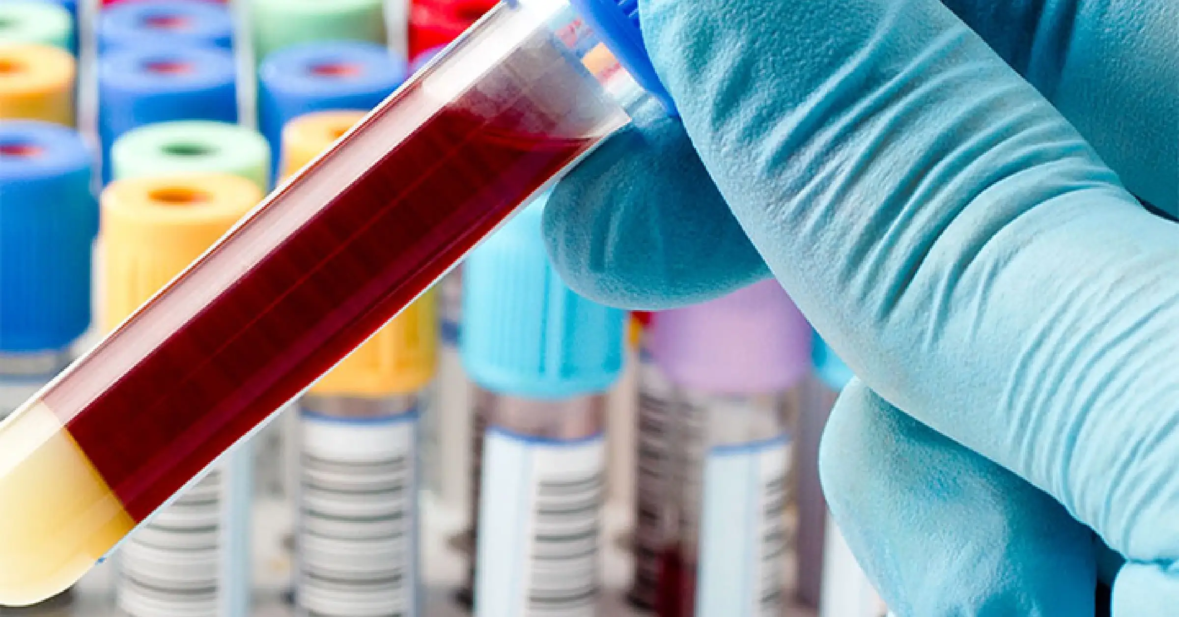¿En qué consisten las pruebas de tuberculosis?