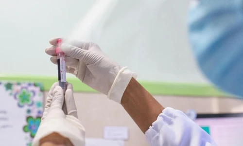 ¿Se hacen pruebas de ETS a adolescentes para sacar la Green Card?