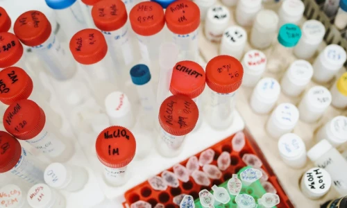 Exámenes de laboratorio para sacar la Green Card