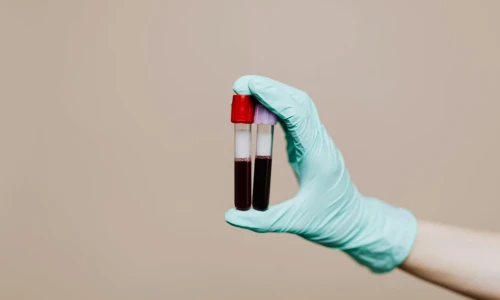 ¿Cuándo debo hacerme una prueba de tuberculosis?