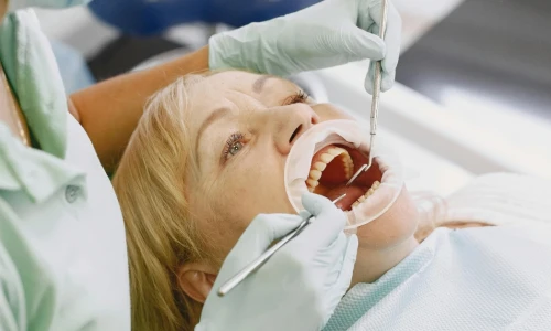 ¿Cada cuándo debes Ir al dentista?
