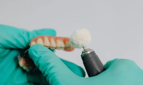 ¿Cuántos espacios dentales puede cubrir un puente dental?