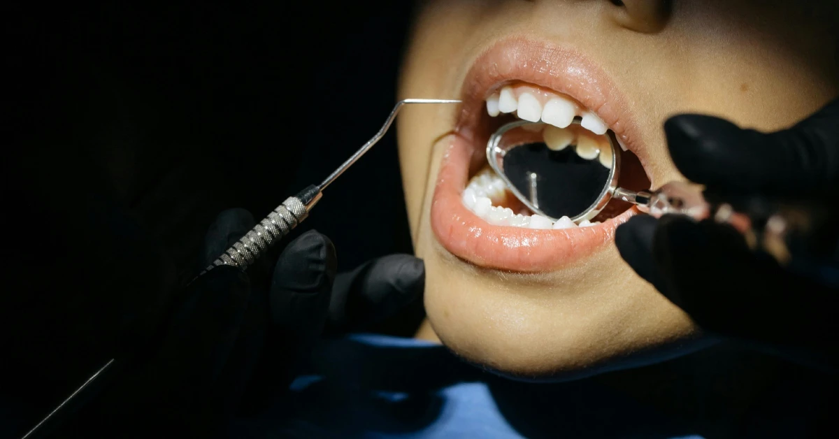 ¿A qué edad puede usar brackets un niño?