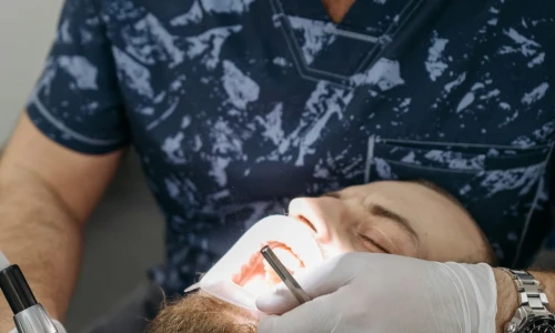 ¿Cuándo es necesario hacer una extracción dental?