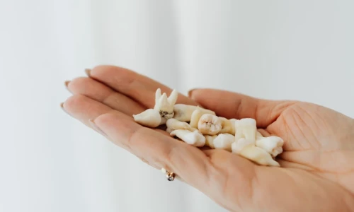 ¿Cómo evitar la pérdida de dientes en la adultez?