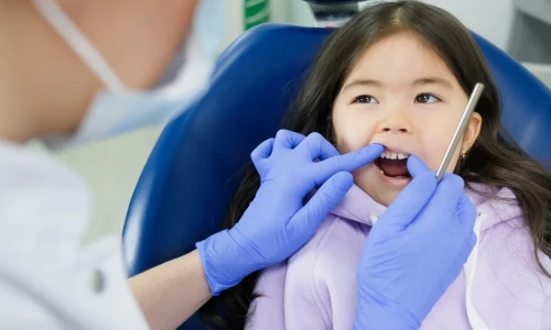 Qué hacer con un diente de leche con caries