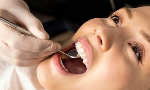 ¿Cómo cuidar la salud de mis encías?