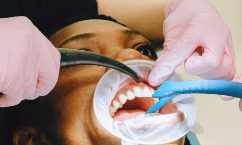 Tengo buena higiene dental, ¿necesito limpiezas dentales regulares?