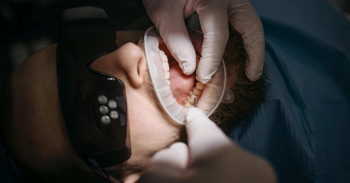 Understanding the Most Common Gum Disease