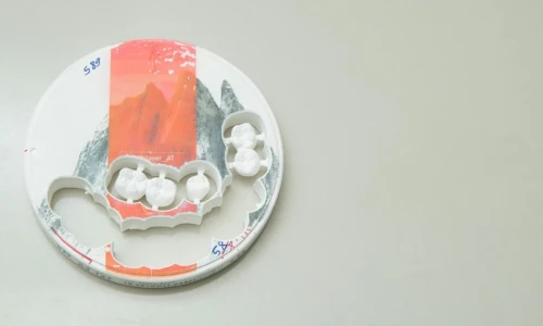 ¿Qué son los puentes dentales?