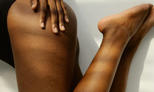 ¿Todas las várices son dolorosas?