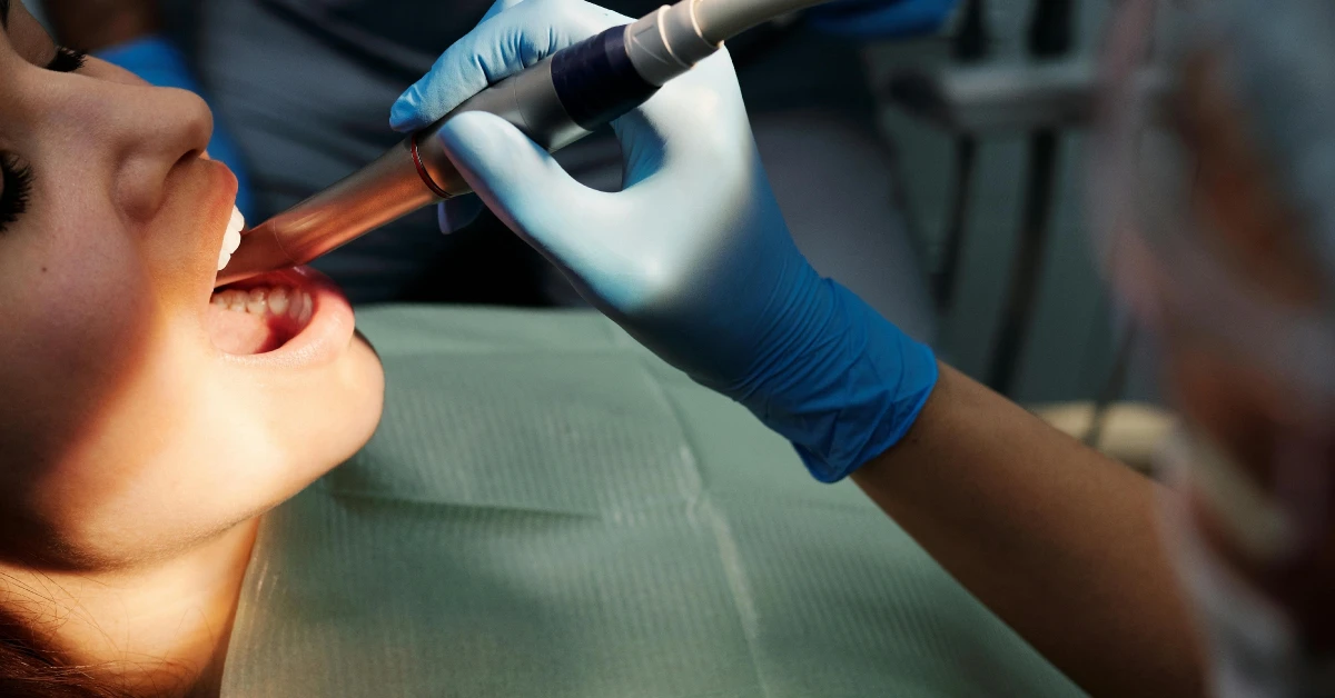 ¿Qué es una limpieza dental profesional y por qué es importante?