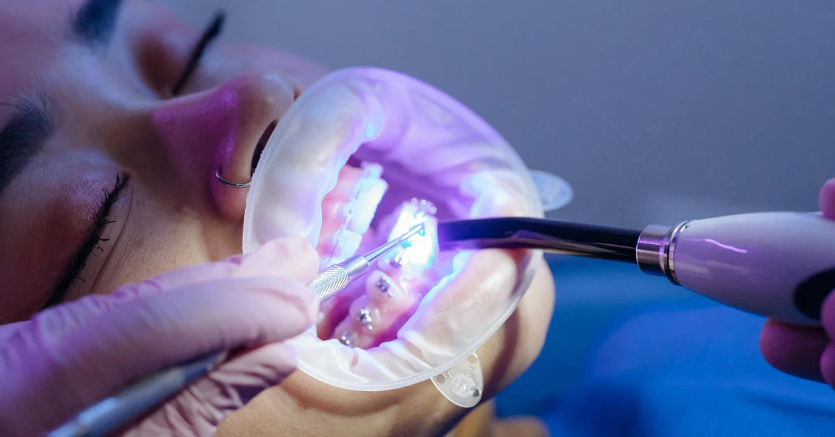 ¿Qué es la odontología estética?