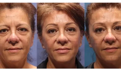 Plastic Surgery Consultation: The Key to a Successful Outcome